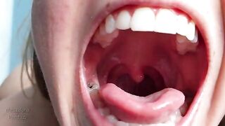 Spit and drool tour of my mouth, just for you